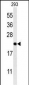 MRAP Antibody (N-term)